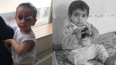 Köpeklerin saldırdığı 2 yaşındaki Ali'den acı haber