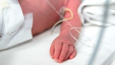 Dünyada ilk... 13 aylık bebeğin hayatını kadavra kurtardı!